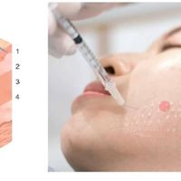 جوانساز روشنی پوست و زیر چشم و تقویت رویش موفقط490|خدمات آرایشگری و زیبایی|تهران, دروازه شمیران|دیوار