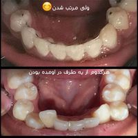 جمعه های ارتودنسی|خدمات آرایشگری و زیبایی|تهران, یاخچی‌آباد|دیوار