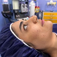 جشنواره بینی و بلفارو و لیفت شقیقه|خدمات آرایشگری و زیبایی|تهران, ونک|دیوار