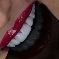 کامپوزیت دندان لمینیت ایمپلنت عصب کشی ارتودنسی|خدمات آرایشگری و زیبایی|تهران, میدان ولیعصر|دیوار