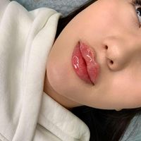 تزریق ژل و بوتاکس وپاک کردن تتو بالیزر و لیزربدن|خدمات آرایشگری و زیبایی|تهران, هفت حوض|دیوار