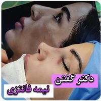 عمل جراحی بینی فقط 25(تعداد محدود)|خدمات آرایشگری و زیبایی|تهران, سعادت‌آباد|دیوار