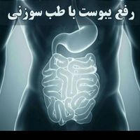 اموزش  و درمان  با طب سوزنی در کلنیک و منزل|خدمات آموزشی|تهران, میدان ولیعصر|دیوار