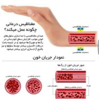 دستبند مغناطیسی درمانی اصل RainSo|جواهرات|تبریز, |دیوار