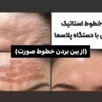 خدمات و اموزش پلاسماجت|خدمات آرایشگری و زیبایی|قم, انصار‌الحسین|دیوار