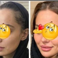 چاقی صورت تضمینی بادستگاه تخصصی و پیشرفته فقط خانم|خدمات آرایشگری و زیبایی|اصفهان, خانه اصفهان|دیوار