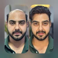مرکز ترمیم مو /ایران مو /|خدمات آرایشگری و زیبایی|اصفهان, آفاران|دیوار