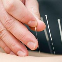 برگزاری همایش طب سوزنی صفر تا صد|گردهمایی و همایش|تهران, خاوران|دیوار