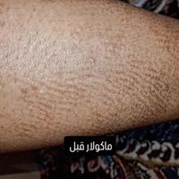 پماد شاهو|آرایشی، بهداشتی، درمانی|تهران, آجودانیه|دیوار