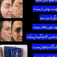 مشاور پوست و مو روتین پوستی کرم های ضدجوش لک چروک|آرایشی، بهداشتی، درمانی|تهران, باغ فیض|دیوار