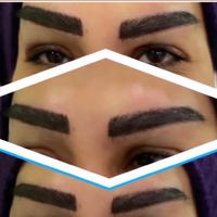 کاشت مو با ضمانت فقط ۸ میلیون|خدمات آرایشگری و زیبایی|تهران, زعفرانیه|دیوار