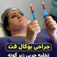 جشنواره بلفاروپلاستی،سانترال لب،غبغب و بوکال فت|خدمات آرایشگری و زیبایی|تهران, پاسداران|دیوار