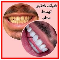 کامپوزیت دندان پالیش دندانپزشکی ترمیم لمینت|خدمات آرایشگری و زیبایی|تهران, تهرانپارس غربی|دیوار