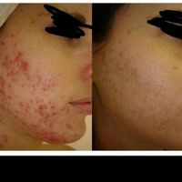 چاقی صورت تضمینی بادستگاه تخصصی و پیشرفته فقط خانم|خدمات آرایشگری و زیبایی|اصفهان, خانه اصفهان|دیوار