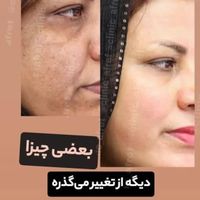 مشاوره برای تناسب اندام و کاهش وزن سریع|آرایشی، بهداشتی، درمانی|ایلام, |دیوار