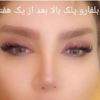 لیفت کامل صورت ۲۵ملیون|خدمات آرایشگری و زیبایی|تهران, قیطریه|دیوار