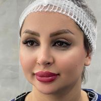 کاشت ابرو ۴ زاویه ای|خدمات آرایشگری و زیبایی|تهران, سعادت‌آباد|دیوار