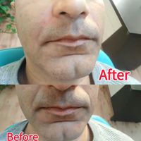 لیزرموی زایدتضمینی ژل وبوتاکس کلینیک دکتر بهرامی|خدمات آرایشگری و زیبایی|تهران, افسریه|دیوار
