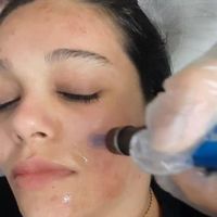 مدل فیشیال وپاکسازی وتتوی بدن وشیدینگ|خدمات آرایشگری و زیبایی|اصفهان, مهدی آباد|دیوار