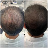 موهاتو پرپشت کن در سه ساعت|خدمات آرایشگری و زیبایی|تهران, صادقیه|دیوار
