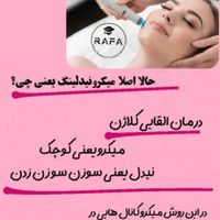 رفع کک و مک در یک جلسه   و پاکسازی عمیق پوست|خدمات آرایشگری و زیبایی|قم, شهید بهشتی|دیوار