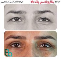 کاشت ابرو در تهران بسیار طبیعی|خدمات آرایشگری و زیبایی|قم, صفائیه|دیوار