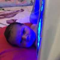 اجاره دستگاه phototherapy)(زردی(نوزاد)۲۴ ساعته|پزشکی|تهران, نعمت‌آباد|دیوار