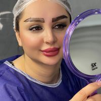 کاشت ابرو ۴ زاویه ای|خدمات آرایشگری و زیبایی|تهران, سعادت‌آباد|دیوار