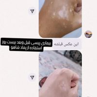 پماد شاهو|آرایشی، بهداشتی، درمانی|تهران, آجودانیه|دیوار