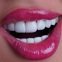 کامپوزیت دندان،لمینیت،روکش،عصب کشی|خدمات آرایشگری و زیبایی|تهران, سعادت‌آباد|دیوار