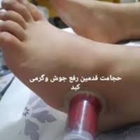 حجامت،رگ گیری غمز،زالو ،فصد،بادکش در شهرک ولیعصر|خدمات آرایشگری و زیبایی|تهران, شهرک ولیعصر|دیوار