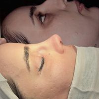 عمل جراحی بینی 19میلیون (بدون هزینه کلینیک)|خدمات آرایشگری و زیبایی|تهران, سهروردی|دیوار