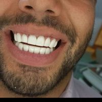 جشنواره ایمپلنت .اوردنچر  نقد. اقساط|خدمات آرایشگری و زیبایی|تهران, دانشگاه علم و صنعت|دیوار