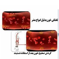 دستبند مغناطیسی درمانی اصل RainSo|جواهرات|تبریز, |دیوار