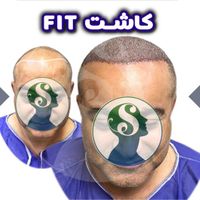 کاشت موی شیرازی|خدمات آرایشگری و زیبایی|تهران, سعادت‌آباد|دیوار