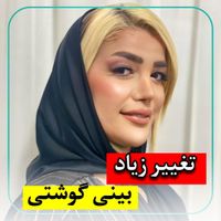 عمل جراحی بینی فقط 25(تعداد محدود)|خدمات آرایشگری و زیبایی|تهران, سعادت‌آباد|دیوار