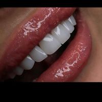 مدل کامپوزیت ونیر فرصت استثنایی به مدت یک هفته|خدمات آرایشگری و زیبایی|تهران, نواب|دیوار