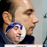 جشنواره جراحی و عمل بینی/لیفت/پلک|خدمات آرایشگری و زیبایی|کرج, درختی|دیوار