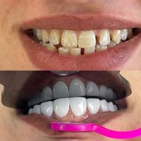 کامپوزیت۳۹۰ گارانتی ۲۰ ساله|خدمات آرایشگری و زیبایی|اهواز, کیانپارس |دیوار
