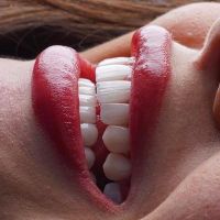 کامپوزیت دندان،لمینیت،روکش،عصب کشی|خدمات آرایشگری و زیبایی|تهران, سعادت‌آباد|دیوار