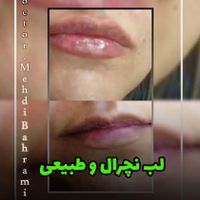 لیزرموی زایدتضمینی ژل وبوتاکس کلینیک دکتر بهرامی|خدمات آرایشگری و زیبایی|تهران, افسریه|دیوار
