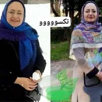 کوره چربیسوز|آرایشی، بهداشتی، درمانی|تهران, آرژانتین|دیوار