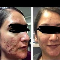 چاقی صورت تضمینی بادستگاه تخصصی و پیشرفته فقط خانم|خدمات آرایشگری و زیبایی|اصفهان, خانه اصفهان|دیوار