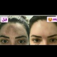 کرم گیاهی اصلی صدرصد تضمینی معجزه|آرایشی، بهداشتی، درمانی|ایلام, |دیوار