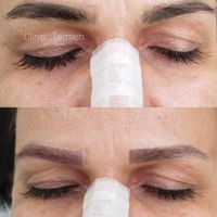 مرکز تخصصی ریمو ابرو، کک مک و خال|خدمات آرایشگری و زیبایی|کرج, شاهین‌ویلا|دیوار