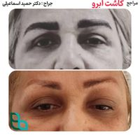 کاشت ابرو در تهران بسیار طبیعی|خدمات آرایشگری و زیبایی|قم, صفائیه|دیوار