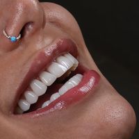 کلینیک تخصصی ایمپلنت و دندانپزشکی نسترن|خدمات آرایشگری و زیبایی|تهران, سهروردی|دیوار