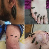دیسک کمر سیاتیک فیزیوتراپی بادکش زالو درمانی حجامت|خدمات آرایشگری و زیبایی|تهران, پلیس|دیوار