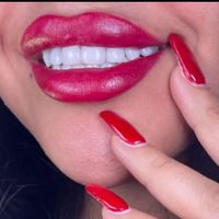 کامپوزیت دندان|خدمات آرایشگری و زیبایی|تهران, تهرانپارس شرقی|دیوار