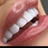 مدل کامپوزیت ونیر فرصت استثنایی به مدت یک هفته|خدمات آرایشگری و زیبایی|تهران, نواب|دیوار